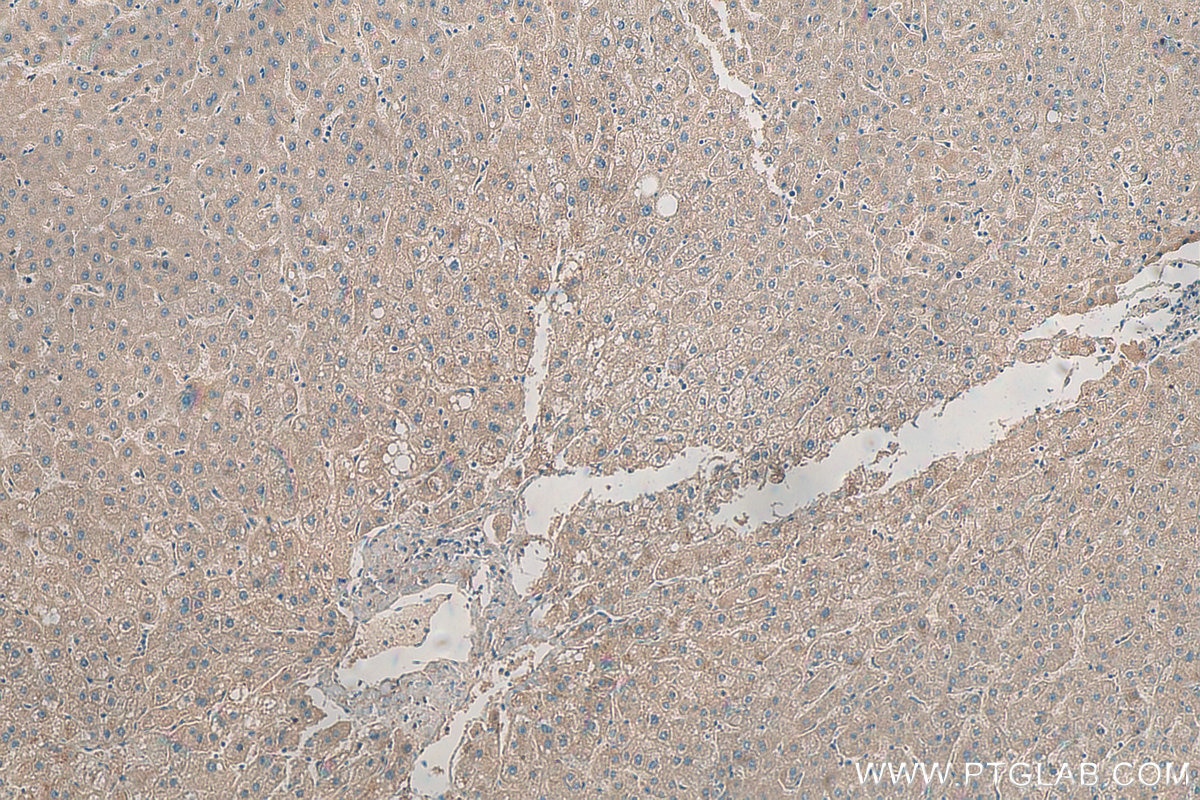 Immunohistochemistry (IHC) staining of human liver tissue using ADAMTSL4 Polyclonal antibody (15304-1-AP)