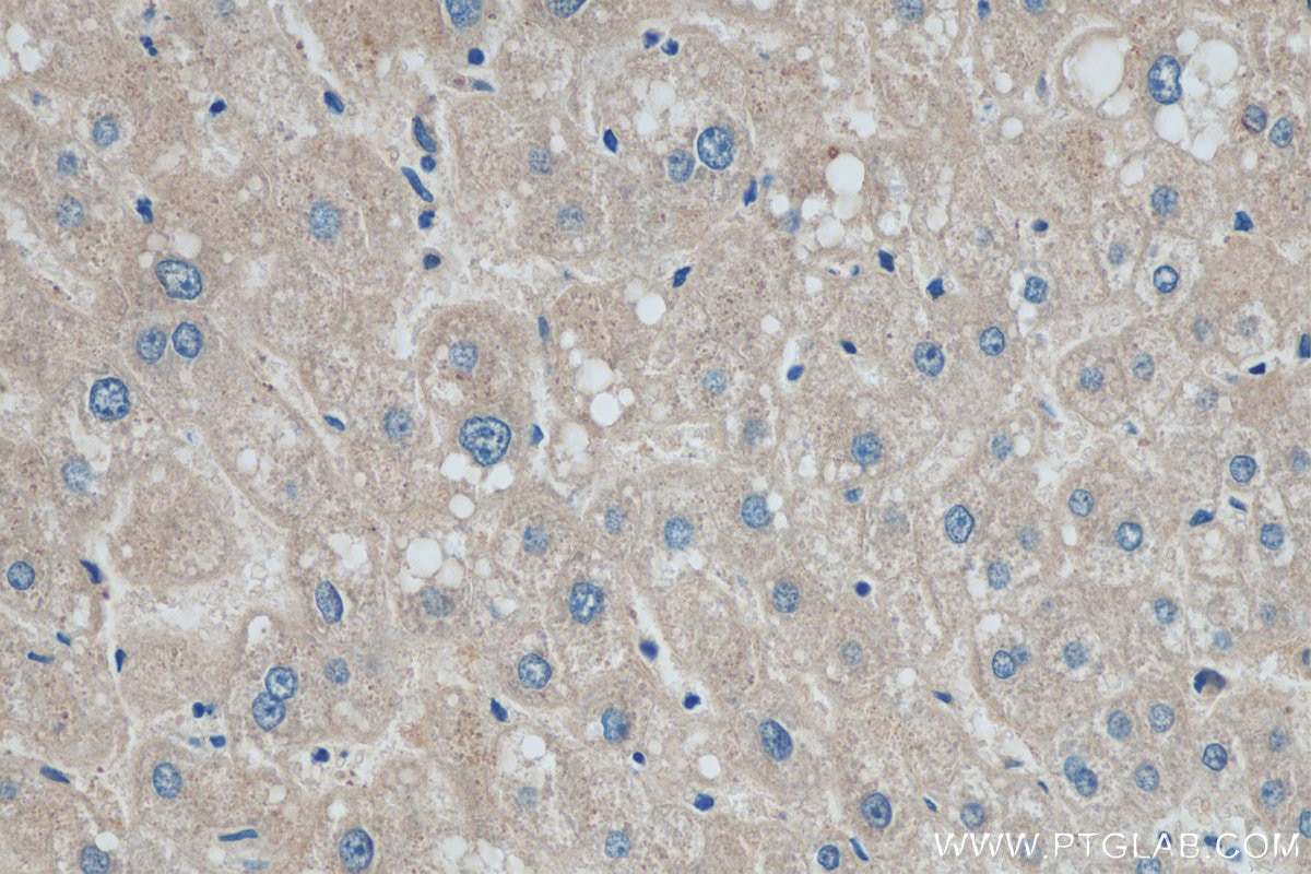 Immunohistochemistry (IHC) staining of human liver tissue using ADAMTSL4 Polyclonal antibody (15304-1-AP)