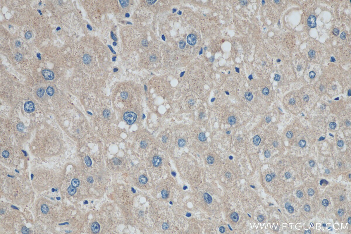 Immunohistochemistry (IHC) staining of human liver tissue using ADAMTSL4 Polyclonal antibody (15304-1-AP)