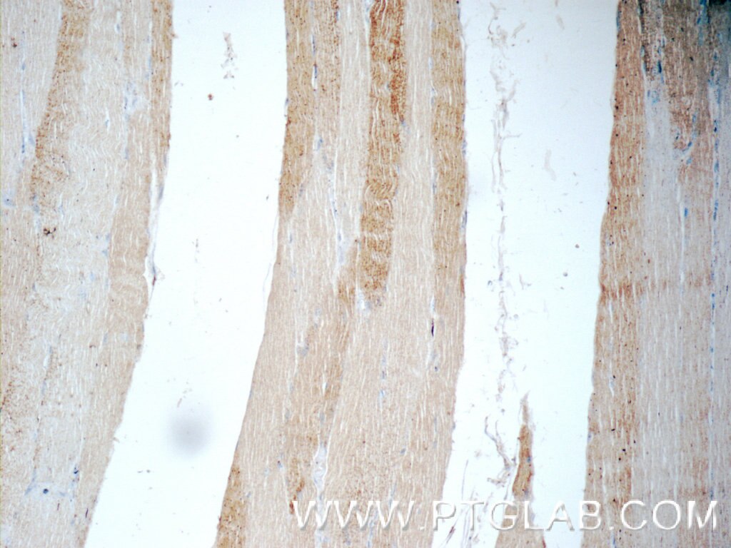 Immunohistochemistry (IHC) staining of human skeletal muscle tissue using ADAMTSL4 Polyclonal antibody (15304-1-AP)