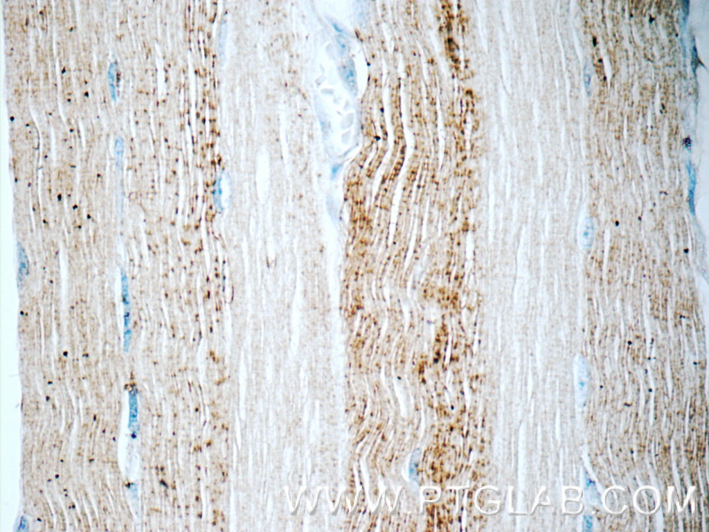 Immunohistochemistry (IHC) staining of human skeletal muscle tissue using ADAMTSL4 Polyclonal antibody (15304-1-AP)