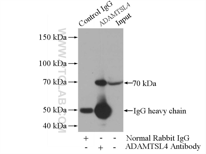 Immunoprecipitation (IP) experiment of mouse brain tissue using ADAMTSL4 Polyclonal antibody (15304-1-AP)