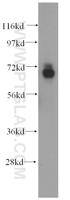 Western Blot (WB) analysis of mouse brain tissue using ADAMTSL4 Polyclonal antibody (15304-1-AP)