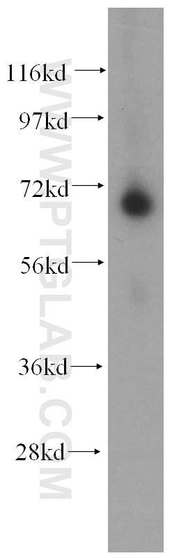 Western Blot (WB) analysis of human liver tissue using ADAMTSL4 Polyclonal antibody (15304-1-AP)