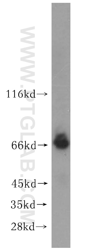 Western Blot (WB) analysis of mouse lung tissue using ADAMTSL4 Polyclonal antibody (15304-1-AP)