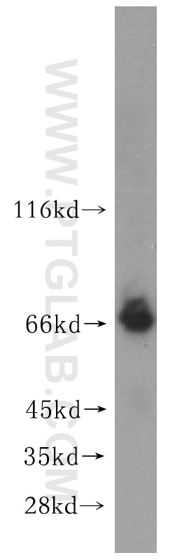 WB analysis of mouse lung using 15304-1-AP