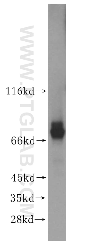 Western Blot (WB) analysis of mouse skeletal muscle tissue using ADAMTSL4 Polyclonal antibody (15304-1-AP)