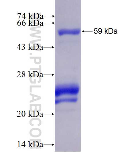 ADAMTSL4 fusion protein Ag7781 SDS-PAGE