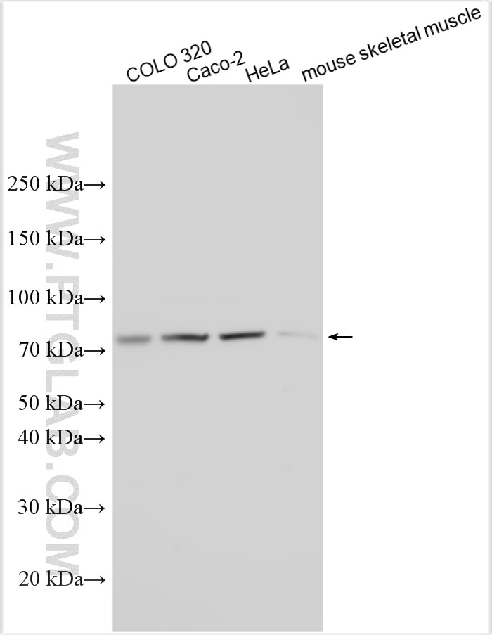 Western Blot (WB) analysis of various lysates using ADAMTSL5 Polyclonal antibody (32965-1-AP)