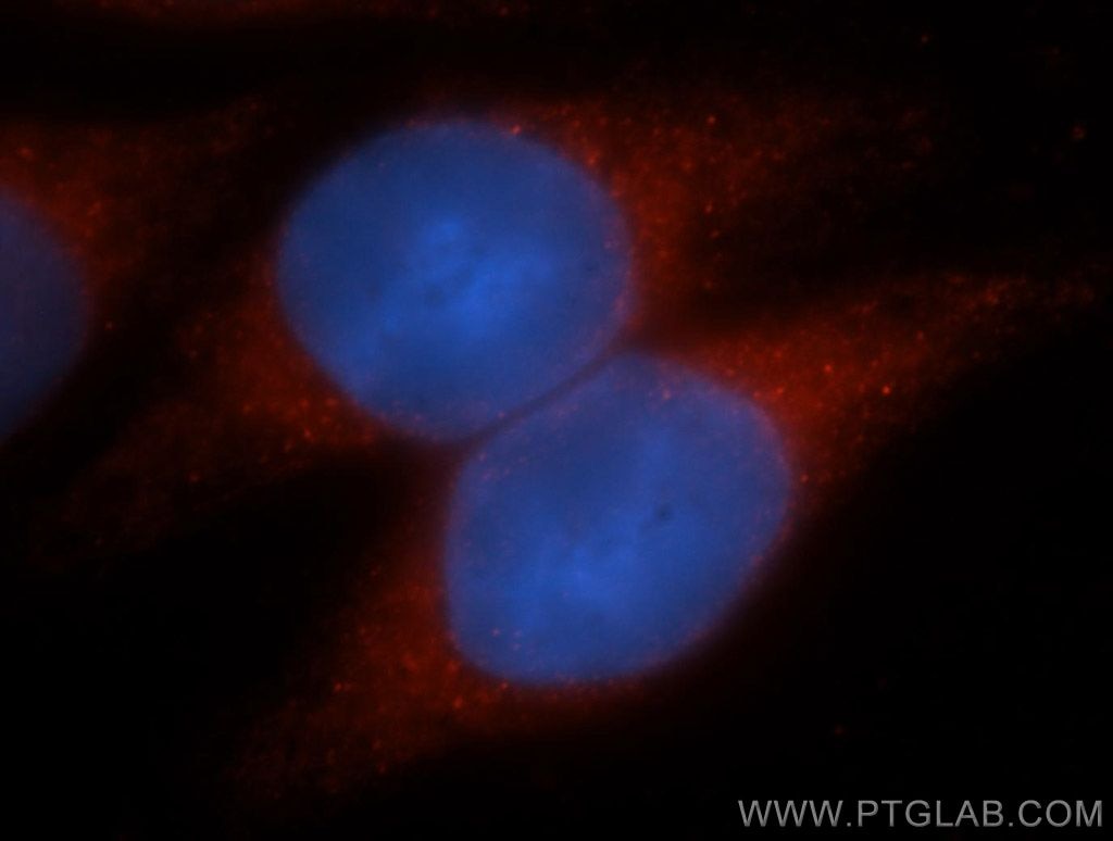 Immunofluorescence (IF) / fluorescent staining of HeLa cells using ADAP1 Polyclonal antibody (13911-1-AP)