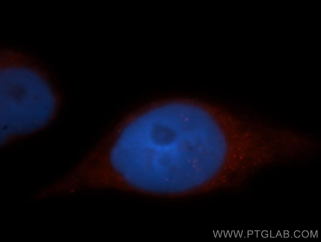 Immunofluorescence (IF) / fluorescent staining of MCF-7 cells using ADAP1 Polyclonal antibody (13911-1-AP)