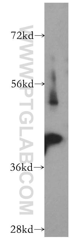 Western Blot (WB) analysis of human brain tissue using ADAP1 Polyclonal antibody (13911-1-AP)