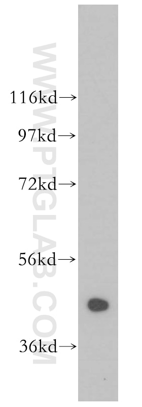 Western Blot (WB) analysis of human brain tissue using ADAP1 Polyclonal antibody (13911-1-AP)