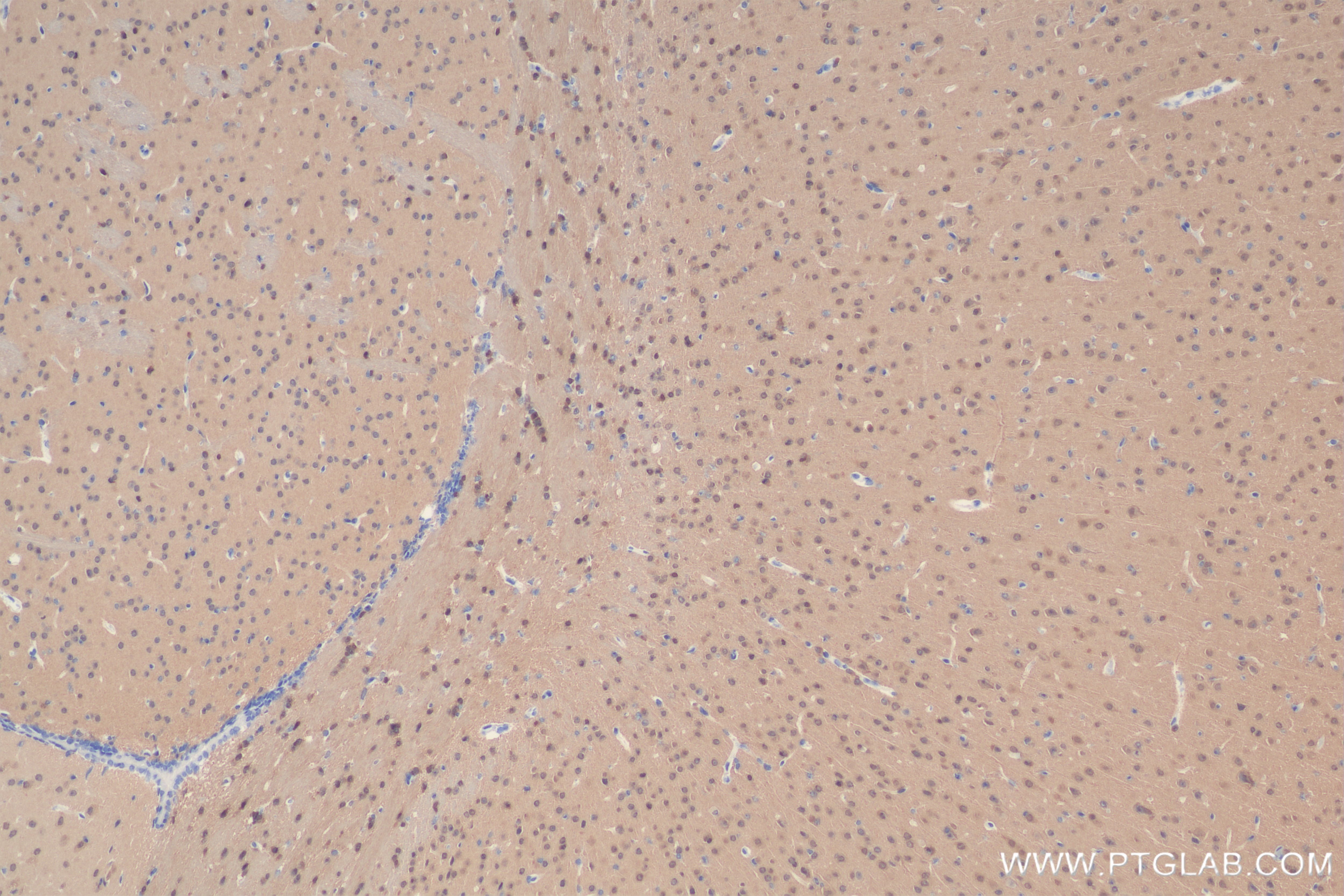 Immunohistochemistry (IHC) staining of mouse brain tissue using ADAP1 Recombinant antibody (84443-1-RR)