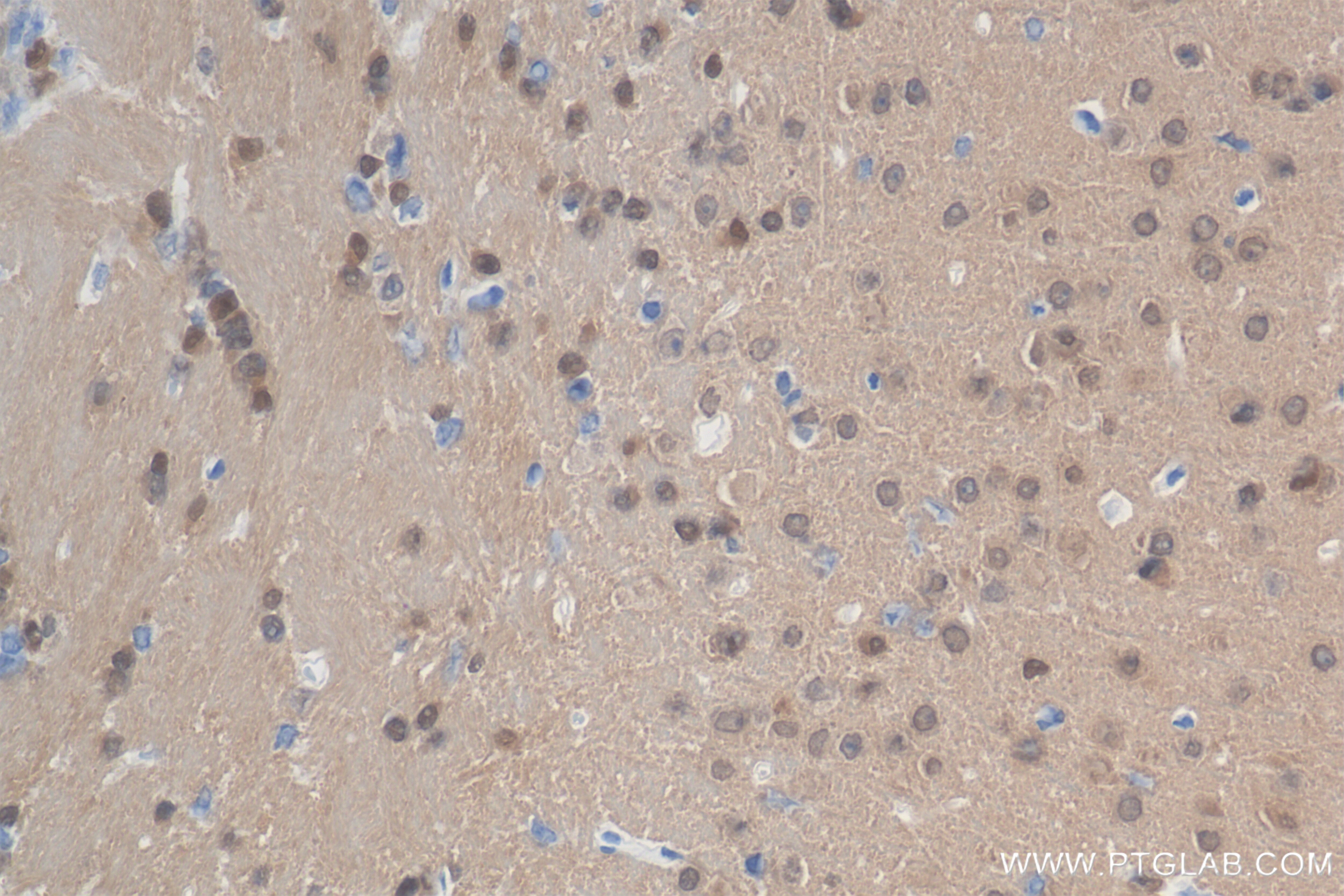 Immunohistochemistry (IHC) staining of mouse brain tissue using ADAP1 Recombinant antibody (84443-1-RR)
