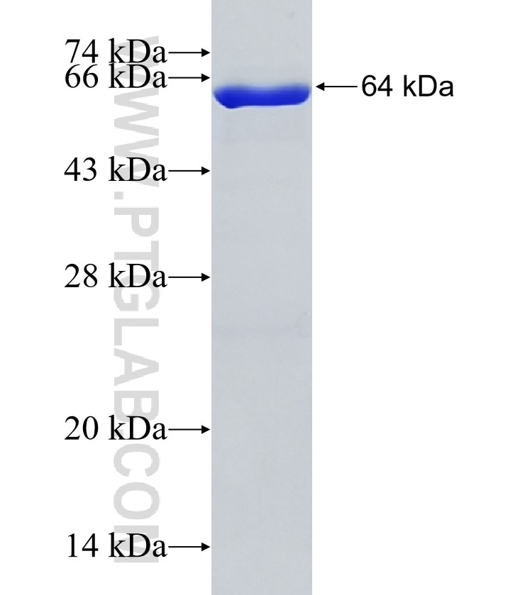 ADAP1 fusion protein Ag4898 SDS-PAGE