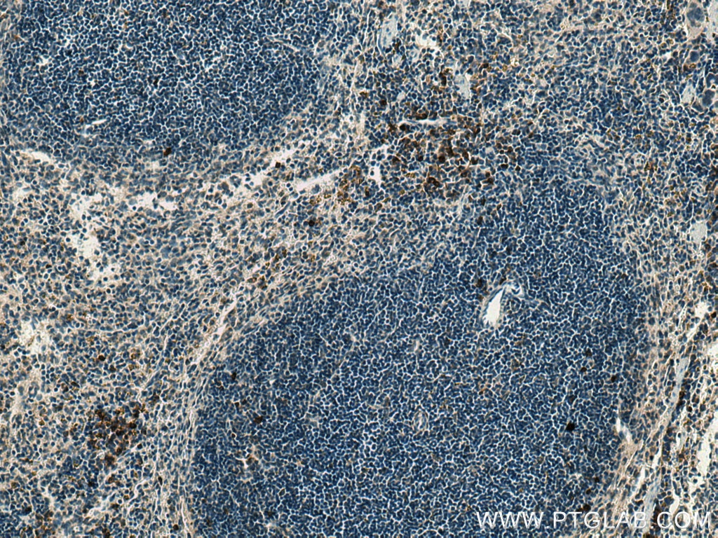 Immunohistochemistry (IHC) staining of mouse spleen tissue using ADAP2 Polyclonal antibody (13706-1-AP)