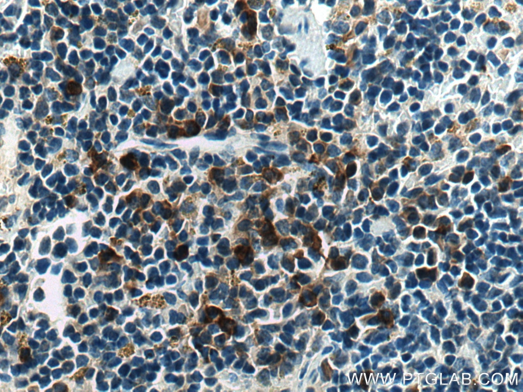 Immunohistochemistry (IHC) staining of mouse spleen tissue using ADAP2 Polyclonal antibody (13706-1-AP)