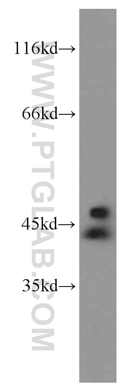 Western Blot (WB) analysis of mouse liver tissue using ADAP2 Polyclonal antibody (13706-1-AP)