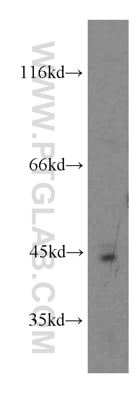 Western Blot (WB) analysis of human placenta tissue using ADAP2 Polyclonal antibody (13706-1-AP)