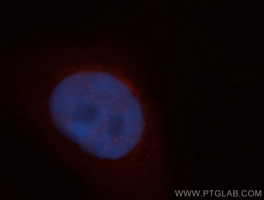 Immunofluorescence (IF) / fluorescent staining of HepG2 cells using ADAR1 Polyclonal antibody (14330-1-AP)