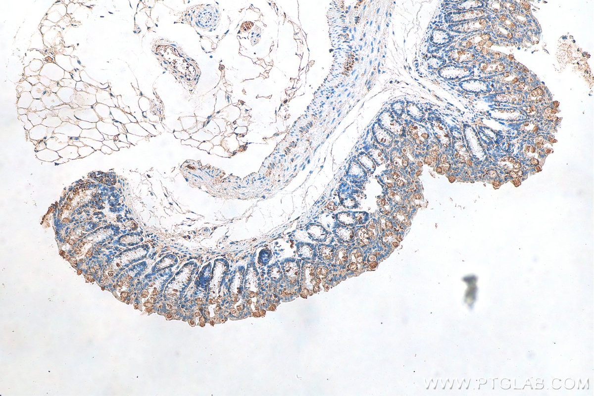 Immunohistochemistry (IHC) staining of mouse colon tissue using ADAR1 Polyclonal antibody (14330-1-AP)