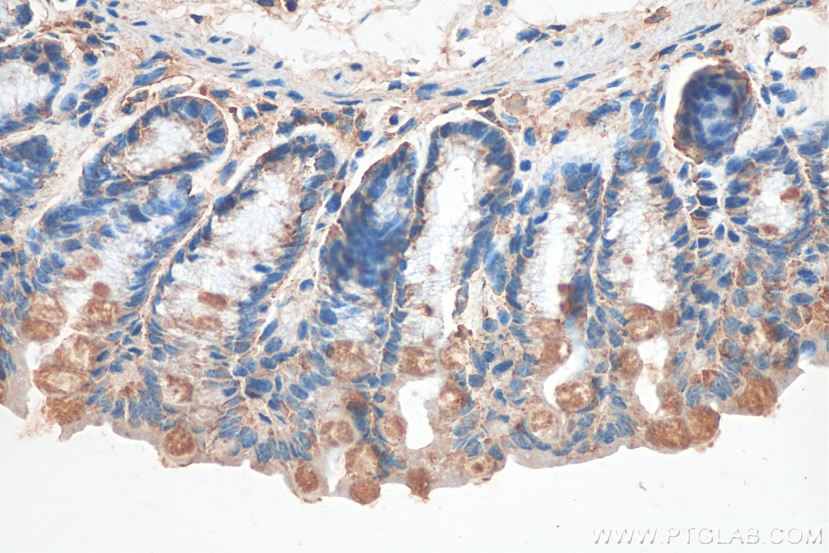Immunohistochemistry (IHC) staining of mouse colon tissue using ADAR1 Polyclonal antibody (14330-1-AP)