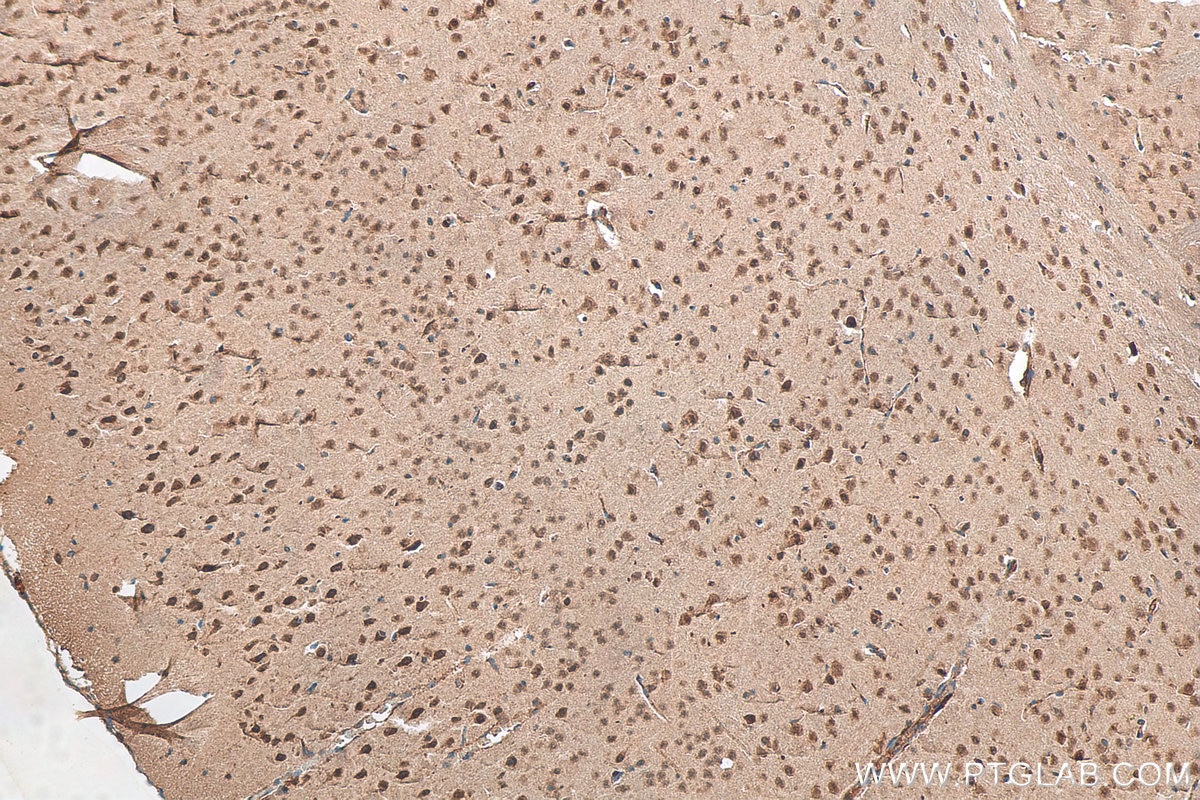 Immunohistochemistry (IHC) staining of mouse brain tissue using ADAR1 Polyclonal antibody (14330-1-AP)