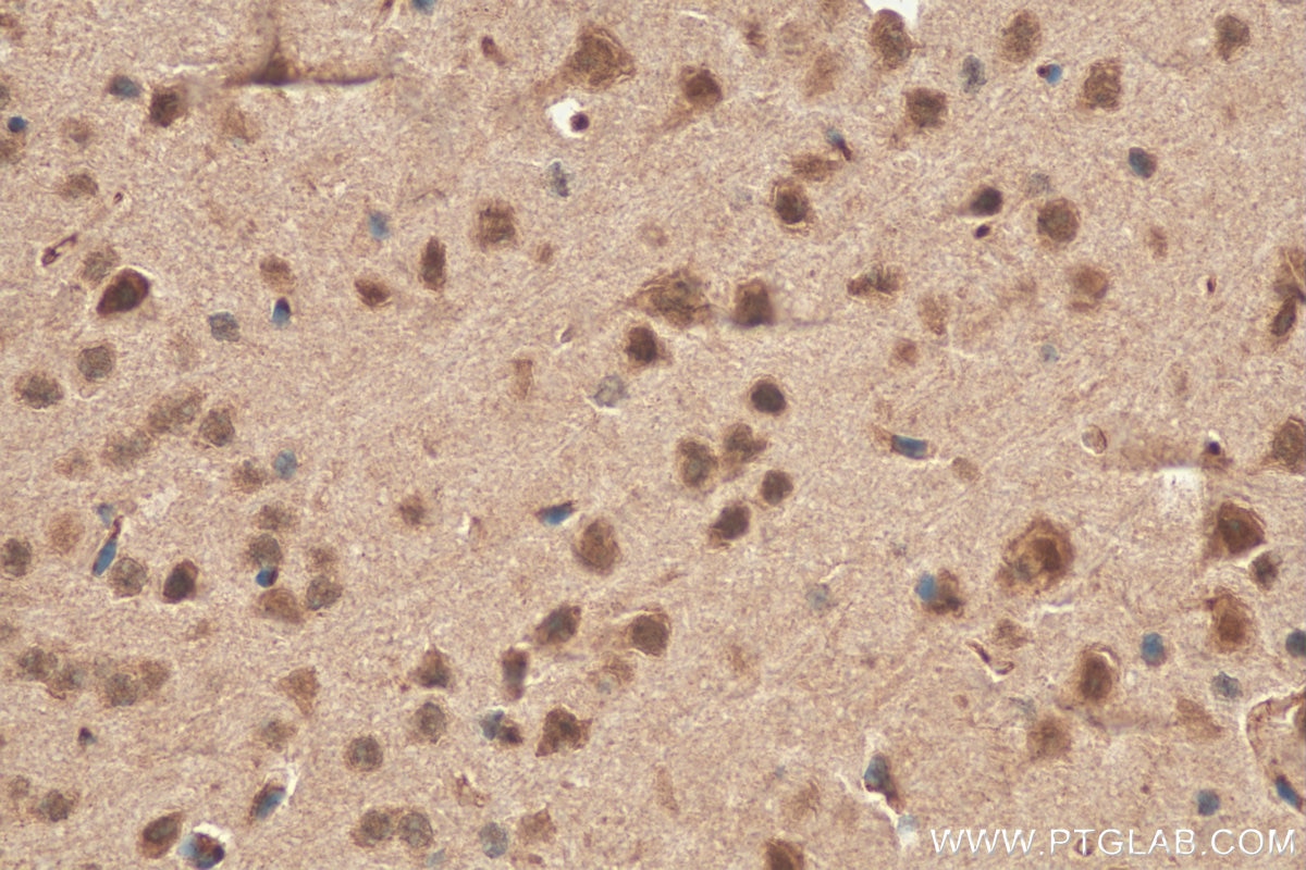 Immunohistochemistry (IHC) staining of mouse brain tissue using ADAR1 Polyclonal antibody (14330-1-AP)