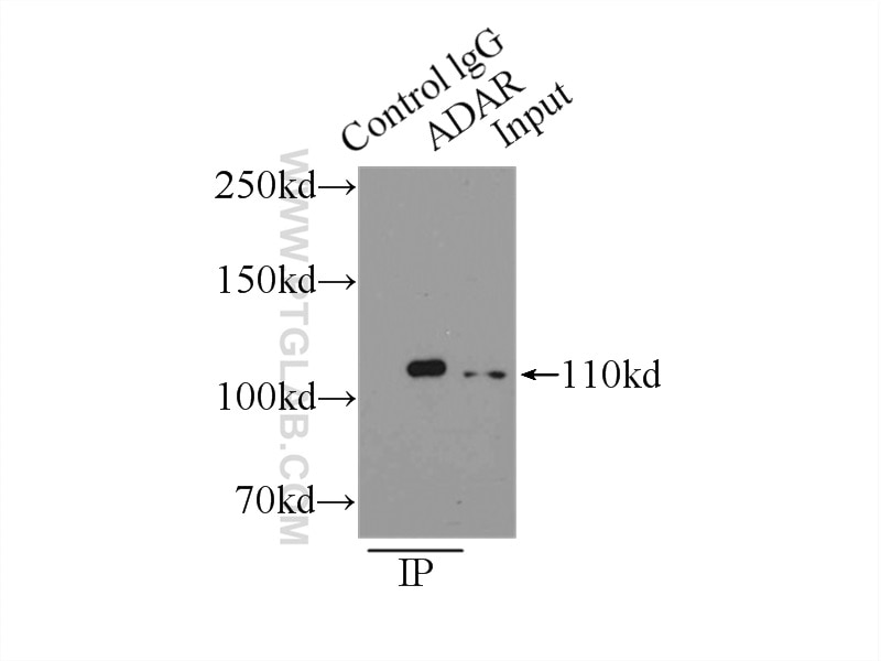 Immunoprecipitation (IP) experiment of Y79 cells using ADAR1 Polyclonal antibody (14330-1-AP)