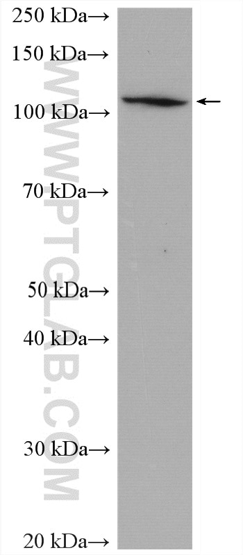 Western Blot (WB) analysis of HepG2 cells using ADAR1 Polyclonal antibody (14330-1-AP)