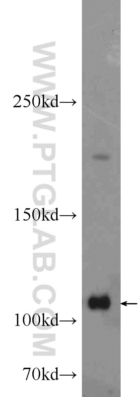 Western Blot (WB) analysis of HeLa cells using ADAR1 Polyclonal antibody (14330-1-AP)