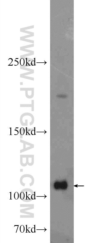 Western Blot (WB) analysis of HeLa cells using ADAR1 Polyclonal antibody (14330-1-AP)
