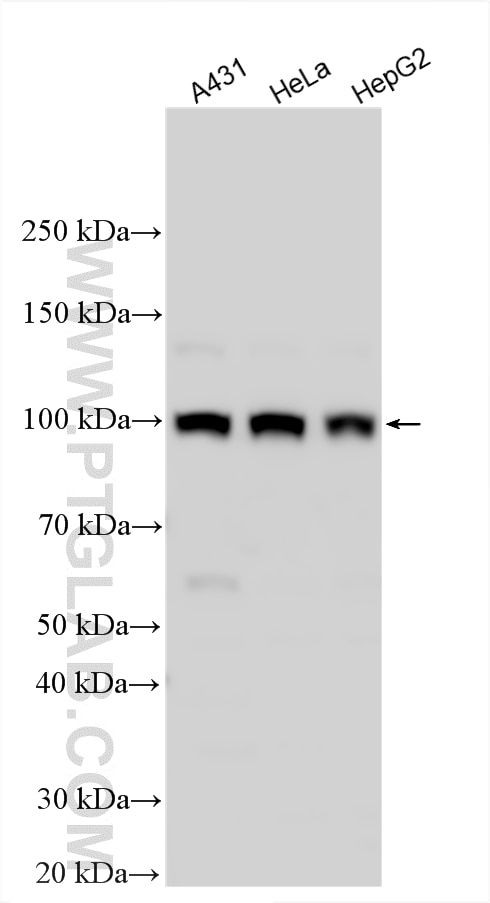 Western Blot (WB) analysis of various lysates using ADAR1 Polyclonal antibody (14330-1-AP)