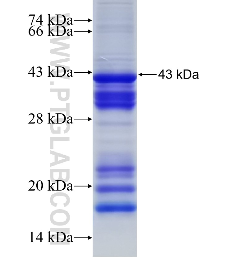 ADAR1 fusion protein Ag5609 SDS-PAGE