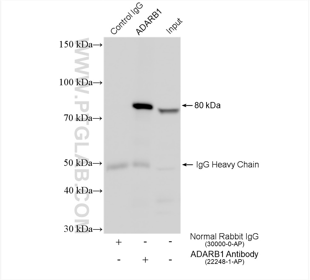 Immunoprecipitation (IP) experiment of HeLa cells using ADARB1 Polyclonal antibody (22248-1-AP)