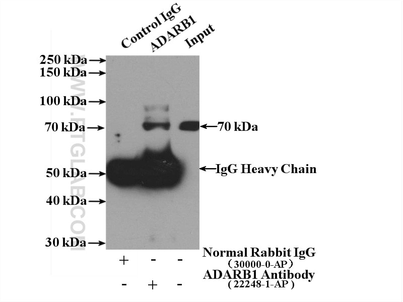 Immunoprecipitation (IP) experiment of A431 cells using ADARB1 Polyclonal antibody (22248-1-AP)