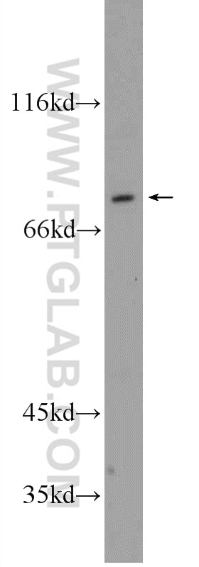 Western Blot (WB) analysis of A431 cells using ADARB1 Polyclonal antibody (22248-1-AP)