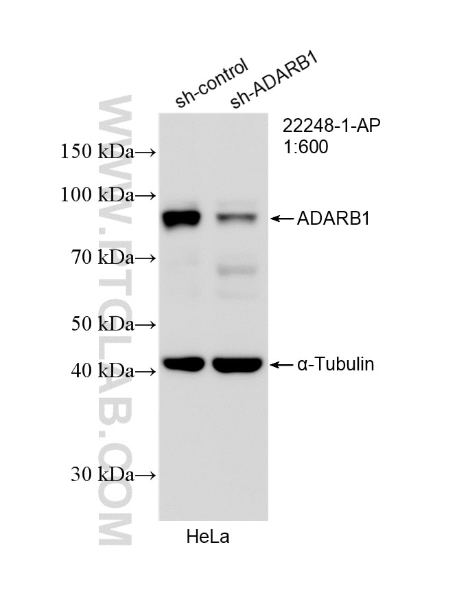 WB analysis of HeLa using 22248-1-AP Western Blot (WB) analysis of HeLa cells using ADARB1 Polyclonal antibody (22248-1-AP)