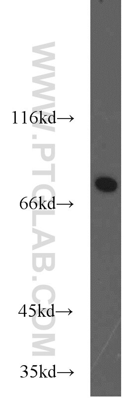 Western Blot (WB) analysis of rat brain tissue using ADARB1 Polyclonal antibody (22248-1-AP)