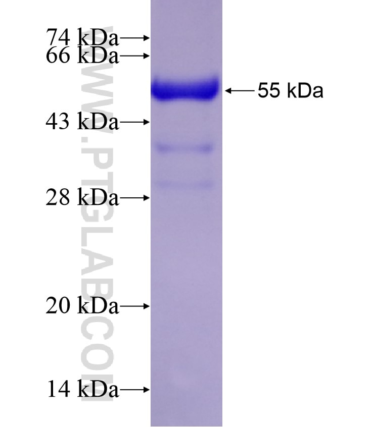 ADARB1 fusion protein Ag17743 SDS-PAGE