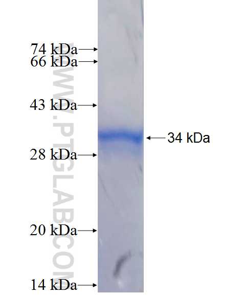 ADARB2 fusion protein Ag26635 SDS-PAGE