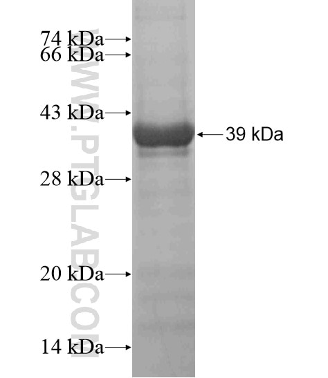 ADARB2 fusion protein Ag18828 SDS-PAGE