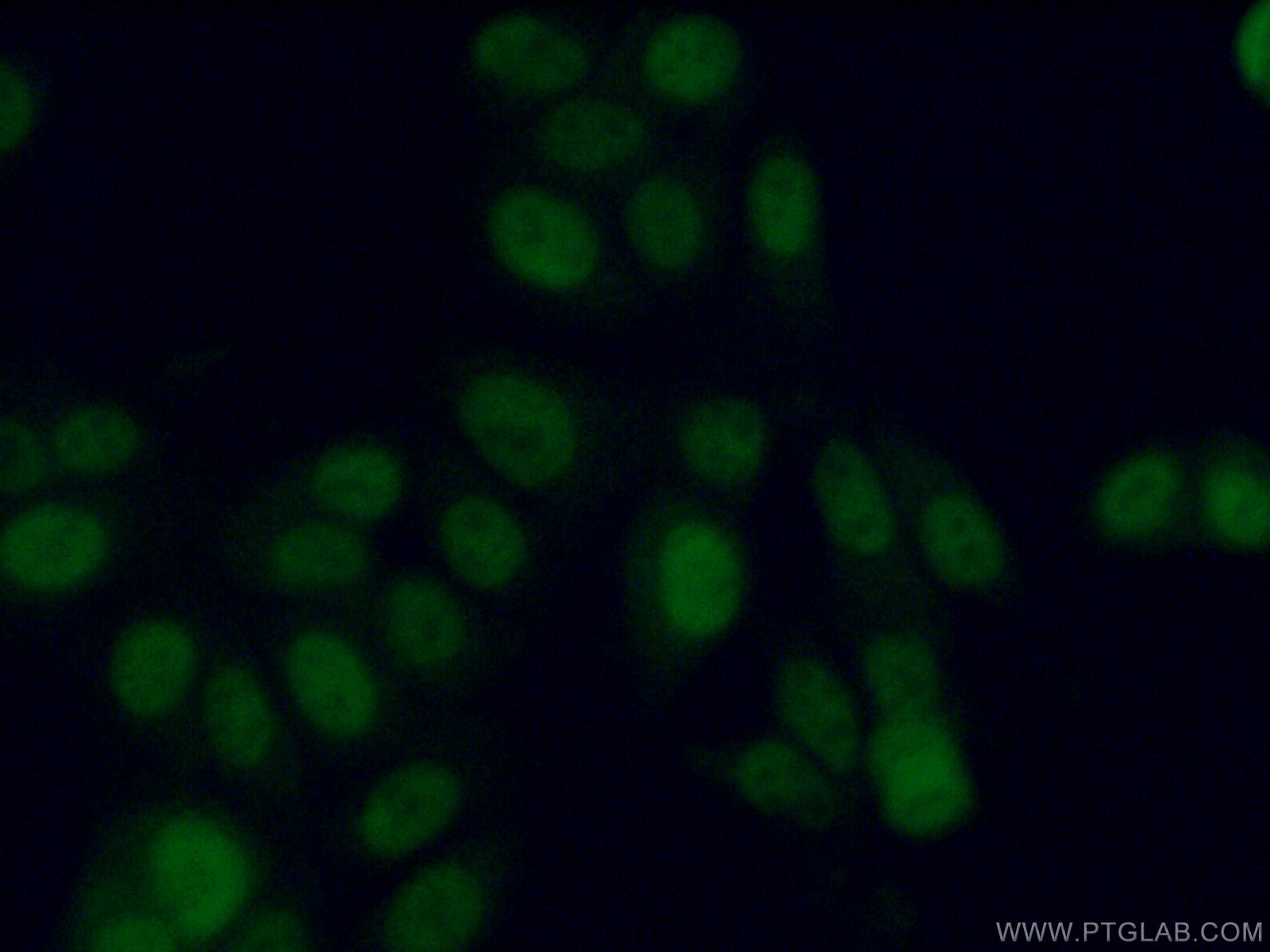 Immunofluorescence (IF) / fluorescent staining of MCF-7 cells using ADAT1 Polyclonal antibody (15482-1-AP)