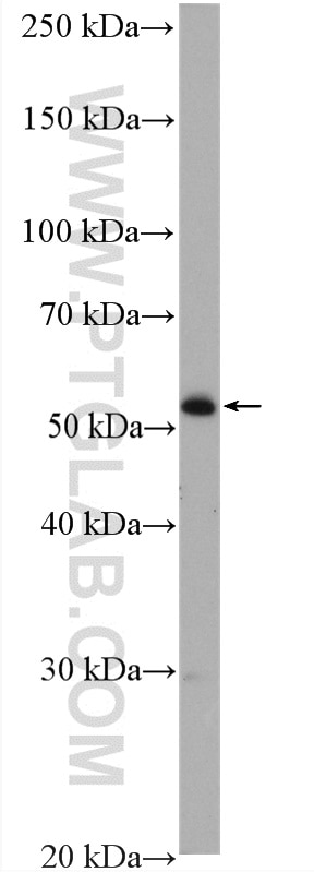 WB analysis of mouse ovary using 15482-1-AP