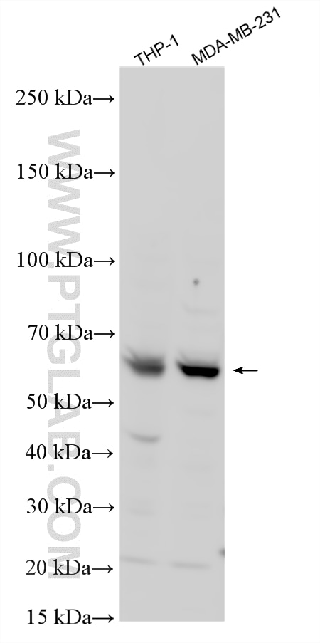 WB analysis using 15482-1-AP Western Blot (WB) analysis of various lysates using ADAT1 Polyclonal antibody (15482-1-AP)
