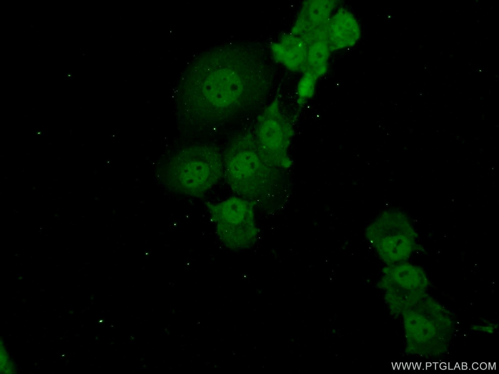 Immunofluorescence (IF) / fluorescent staining of A431 cells using ADAT2 Polyclonal antibody (13621-1-AP)