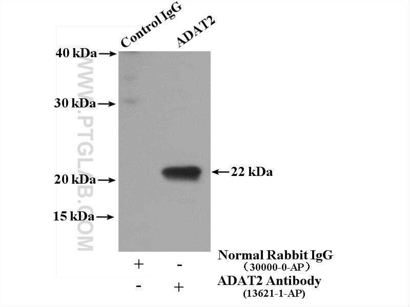 Immunoprecipitation (IP) experiment of mouse brain tissue using ADAT2 Polyclonal antibody (13621-1-AP)