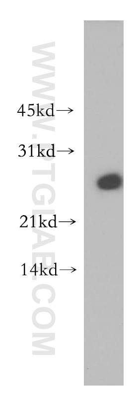 Western Blot (WB) analysis of A431 cells using ADAT2 Polyclonal antibody (13621-1-AP)