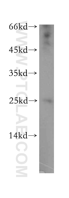 Western Blot (WB) analysis of mouse pancreas tissue using ADAT2 Polyclonal antibody (13621-1-AP)